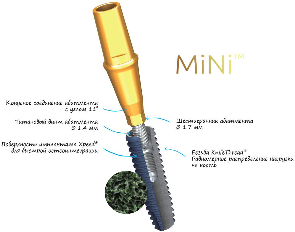 Зубные имплантаты MegaGen Mini MegaGen Mini